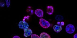 AstraZeneca to acquire TeneoTwo AstraZeneca is planning to acquire TeneoTwo to boost blood cancer treatment. Photo: National Cancer Institute on Unsplash